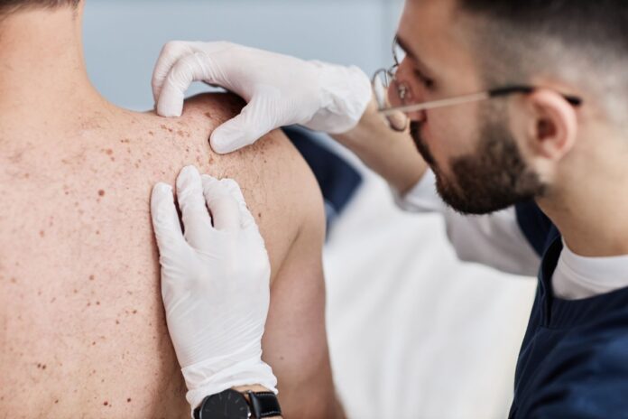 Desinformação e estigmas sobre a hanseníase atrasam cuidados