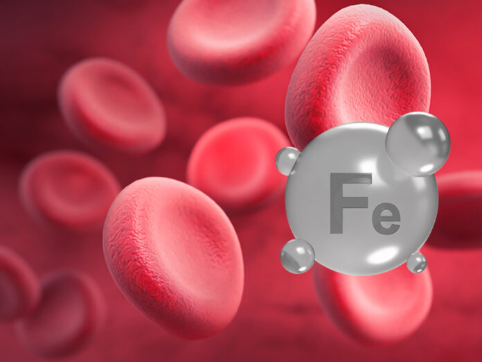 Atraso no PCDT da Sobrecarga de Ferro prejudica pacientes